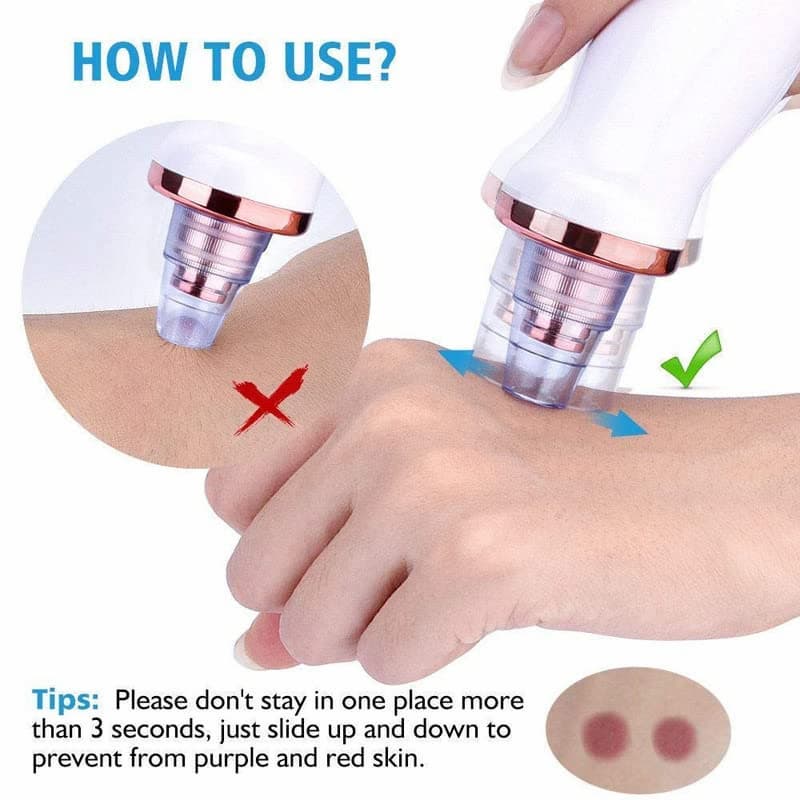 Rechargeable Electric Blackhead Remover & Pore Vacuum Cleaner for Deep Facial Cleansing