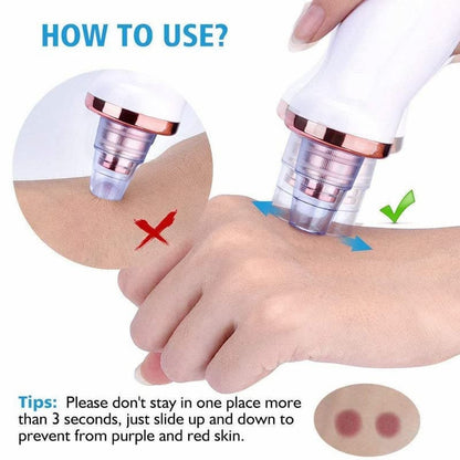Rechargeable Electric Blackhead Remover & Pore Vacuum Cleaner for Deep Facial Cleansing